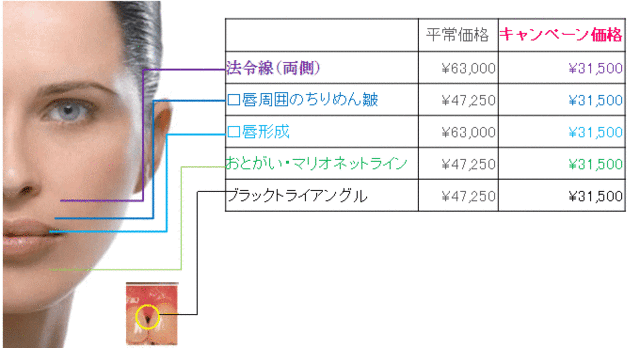 ヒアルロン酸治療 料金